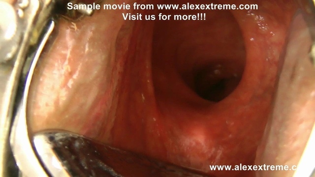 XO speculum and extreme deep anal dildo by Hotkinkyjo